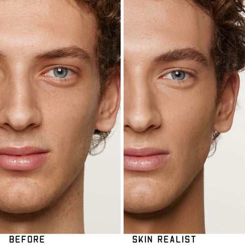 Skin Realist