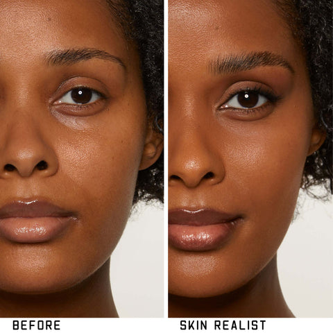 Skin Realist