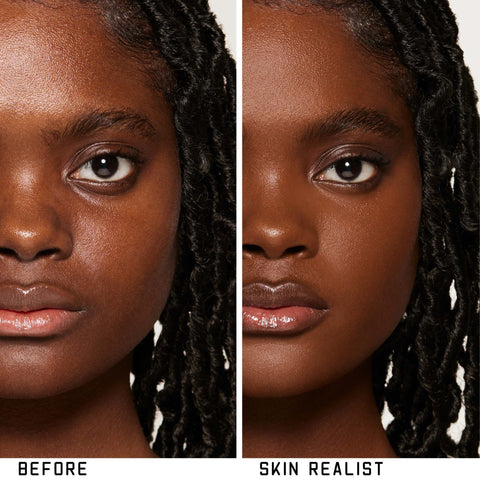 Skin Realist